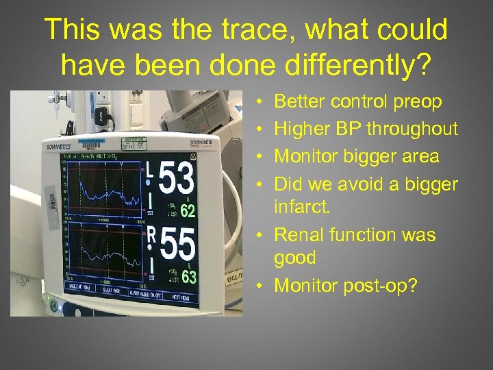 This was the trace, what could have been done differently? • • Better control