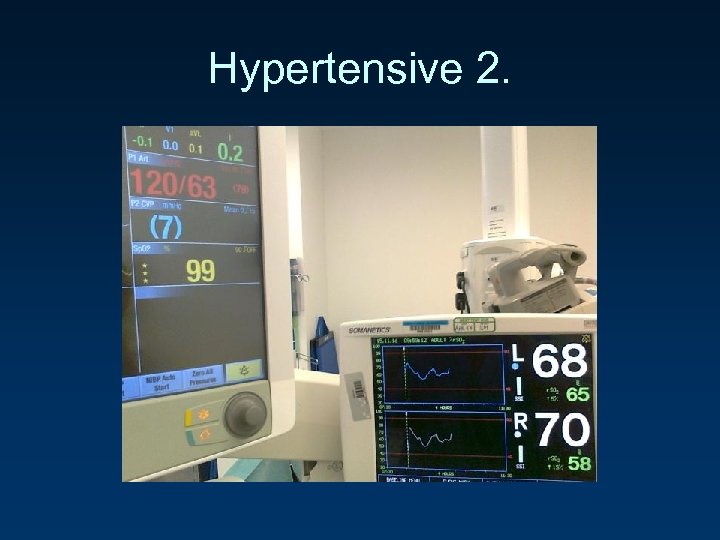 Hypertensive 2. 