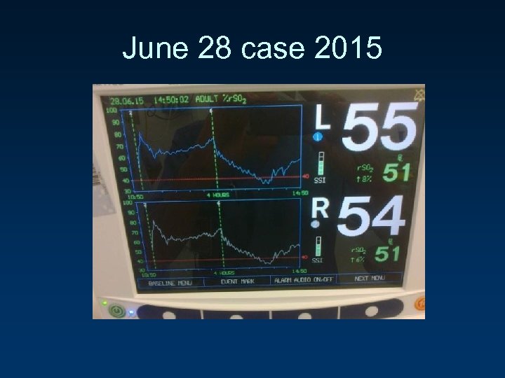 June 28 case 2015 