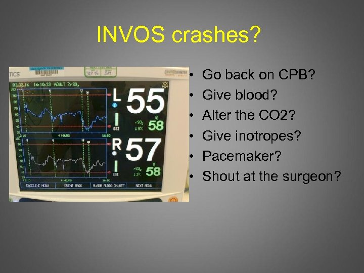 INVOS crashes? • • • Go back on CPB? Give blood? Alter the CO