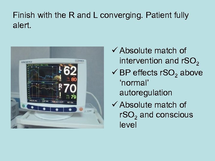 Finish with the R and L converging. Patient fully alert. ü Absolute match of