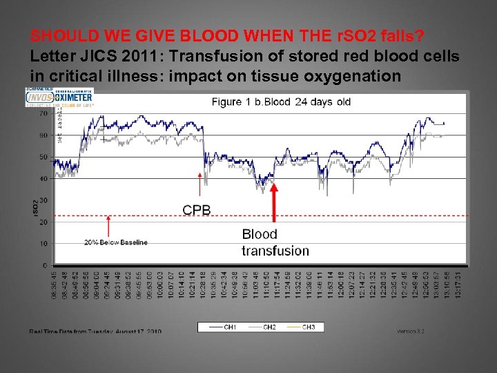SHOULD WE GIVE BLOOD WHEN THE r. SO 2 falls? Letter JICS 2011: Transfusion