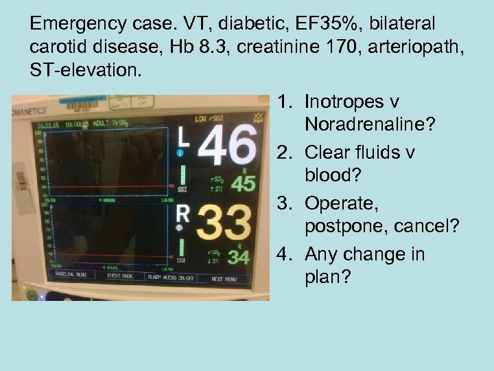 Emergency case. VT, diabetic, EF 35%, bilateral carotid disease, Hb 8. 3, creatinine 170,