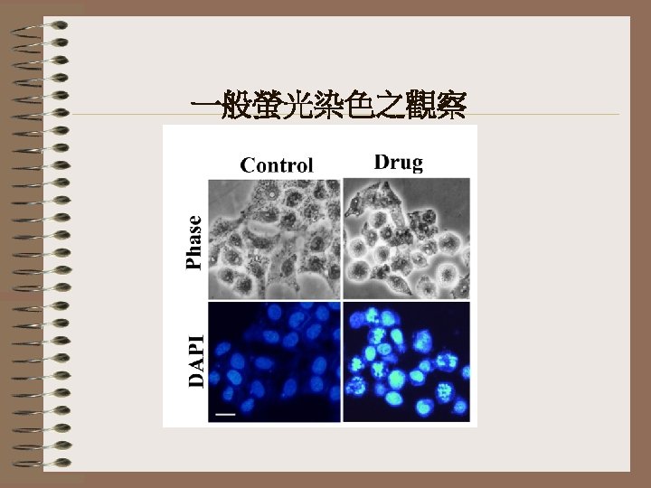 一般螢光染色之觀察 