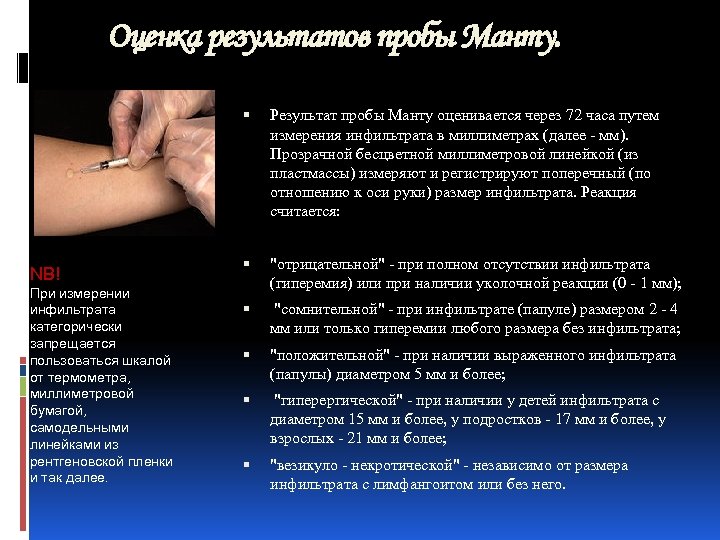 Оценка результатов пробы Манту. NB! При измерении инфильтрата категорически запрещается пользоваться шкалой от термометра,