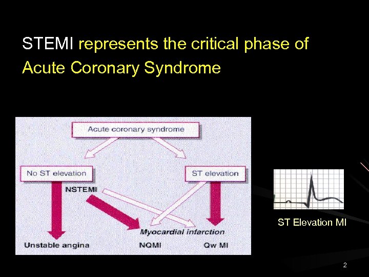 STEMI represents the critical phase of Acute Coronary Syndrome ST Elevation MI 2 