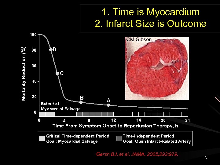 1. Time is Myocardium 2. Infarct Size is Outcome Mortality Reduction (%) 100 D