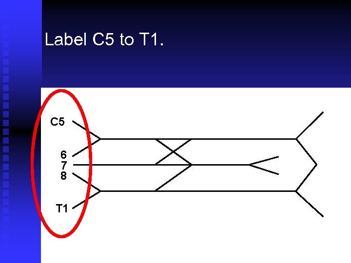 Label C 5 to T 1. 