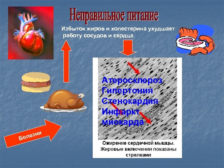Избыток жиров и холестерина ухудшает работу сосудов и сердца. Атеросклероз Гипертония Стенокардия Инфаркт миокарда