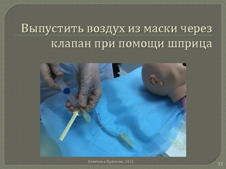 Выпустить воздух из маски через клапан при помощи шприца Алевтина Крюкова, 2015 12 