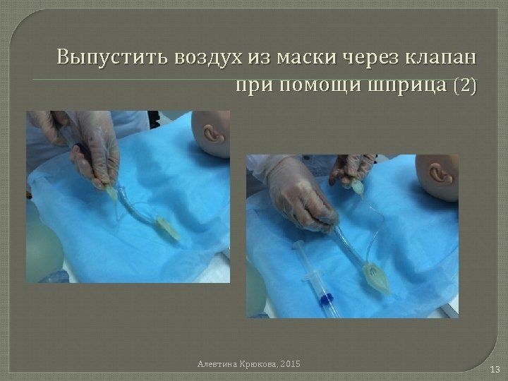Выпустить воздух из маски через клапан при помощи шприца (2) Алевтина Крюкова, 2015 13