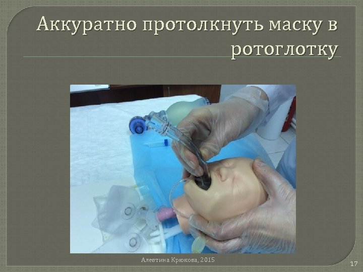 Аккуратно протолкнуть маску в ротоглотку Алевтина Крюкова, 2015 17 