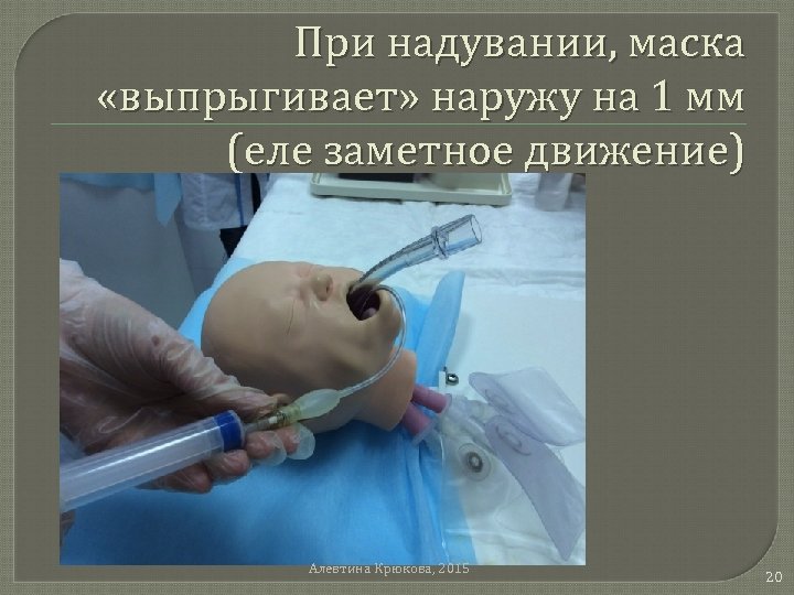 При надувании, маска «выпрыгивает» наружу на 1 мм (еле заметное движение) Алевтина Крюкова, 2015