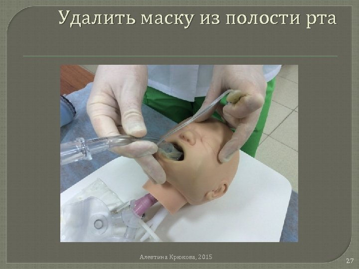 Удалить маску из полости рта Алевтина Крюкова, 2015 27 