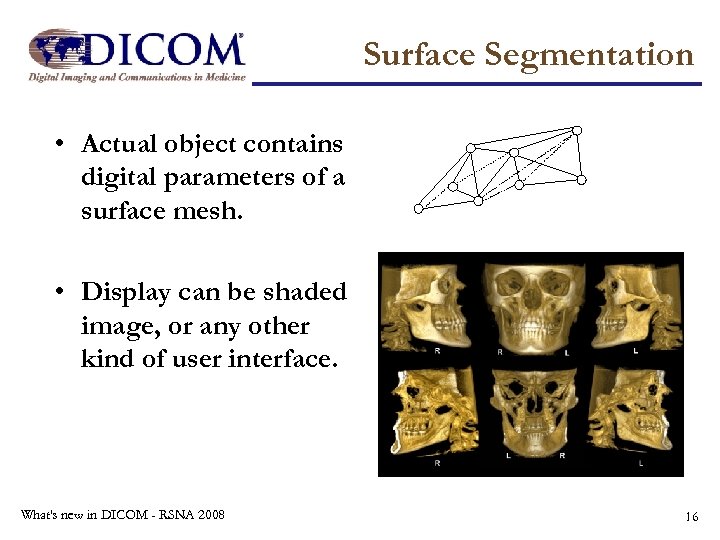 Surface Segmentation • Actual object contains digital parameters of a surface mesh. • Display