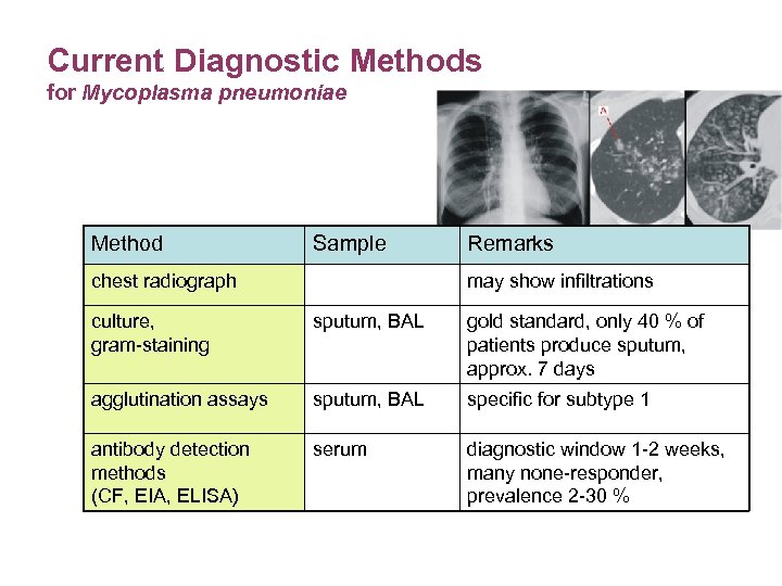 Mycoplasma pneumoniae