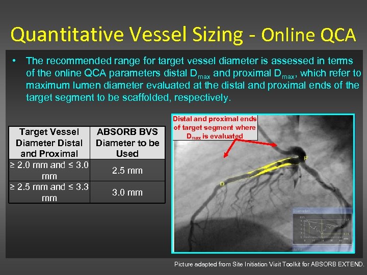 Quantitative Vessel Sizing - Online QCA • The recommended range for target vessel diameter
