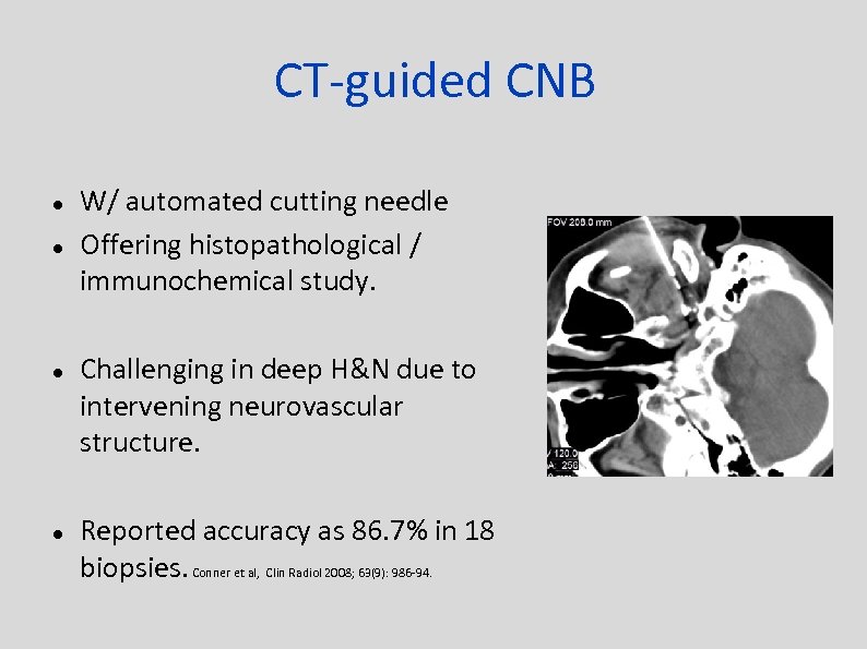 CT-guided CNB W/ automated cutting needle Offering histopathological / immunochemical study. Challenging in deep