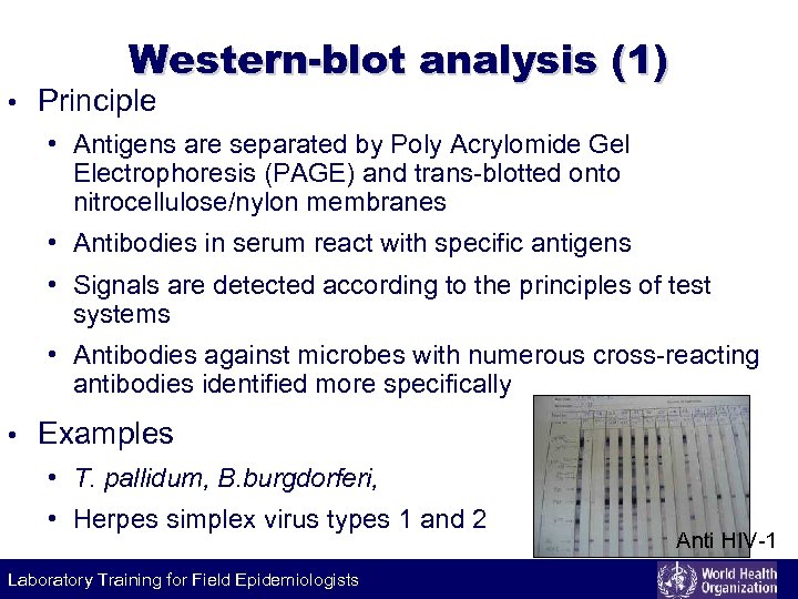 Western-blot analysis (1) • Principle • Antigens are separated by Poly Acrylomide Gel Electrophoresis
