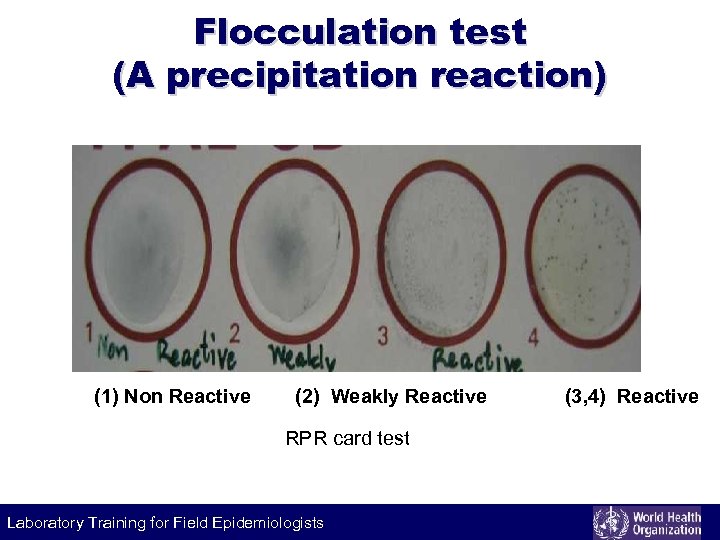 Flocculation test (A precipitation reaction) (1) Non Reactive (2) Weakly Reactive RPR card test