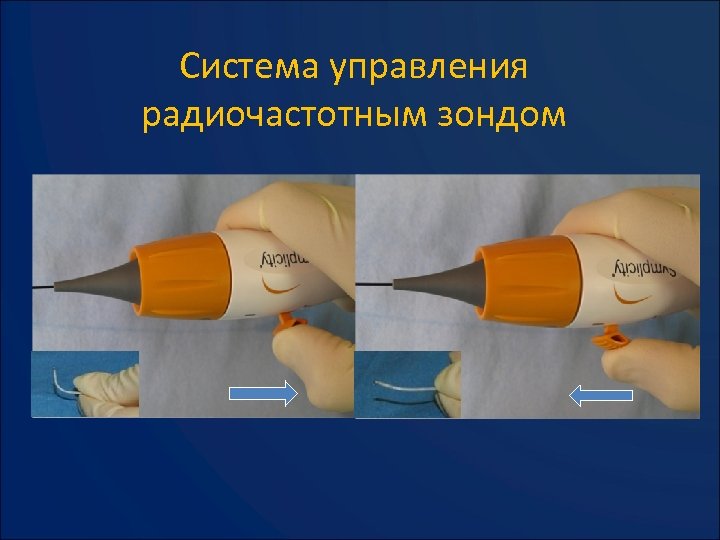 Система управления радиочастотным зондом 
