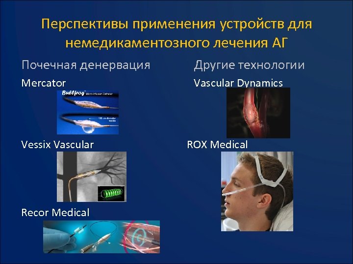 Перспективы применения устройств для немедикаментозного лечения АГ Почечная денервация Другие технологии Mercator Vascular Dynamics