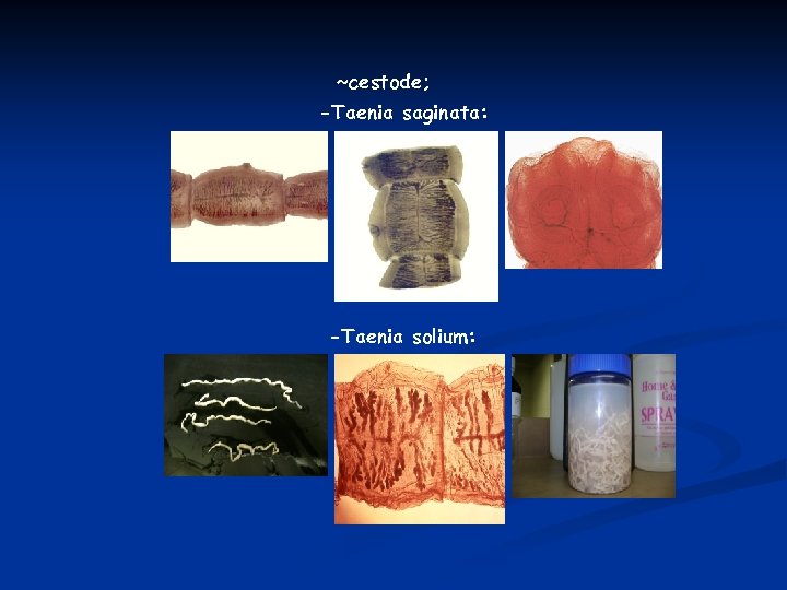 ~cestode; -Taenia saginata: -Taenia solium: 