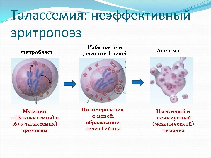Талассемия: неэффективный эритропоэз Эритробласт Мутации 11 (β-талассемия) и 16 (α-талассемия) хромосом Избыток α- и