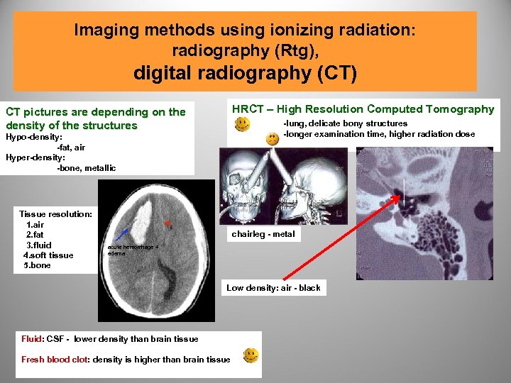 Imaging methods using ionizing radiation: radiography (Rtg), digital radiography (CT) CT pictures are depending