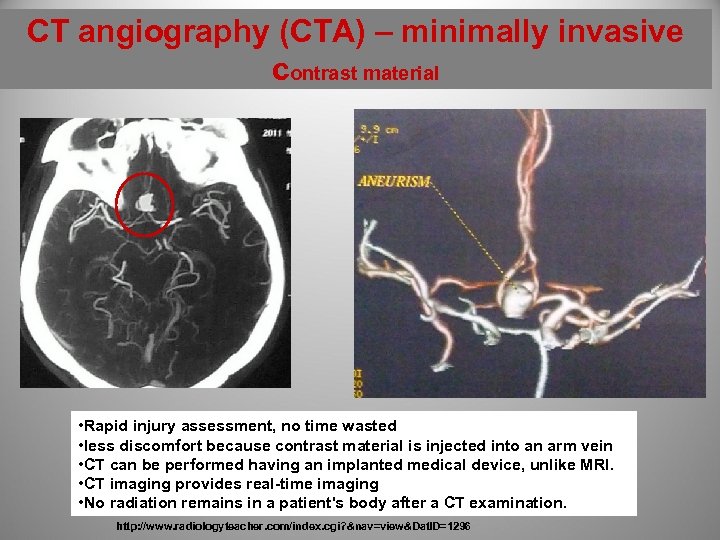 CT angiography (CTA) – minimally invasive contrast material • Rapid injury assessment, no time