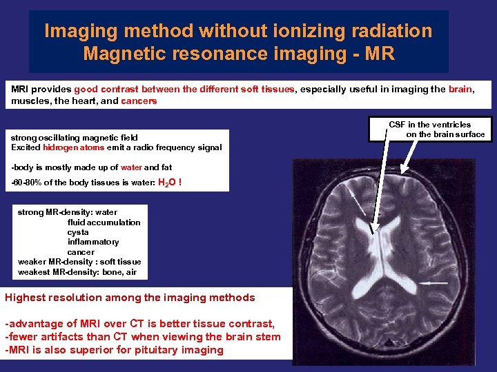 Imaging method without ionizing radiation Magnetic resonance imaging - MR MRI provides good contrast