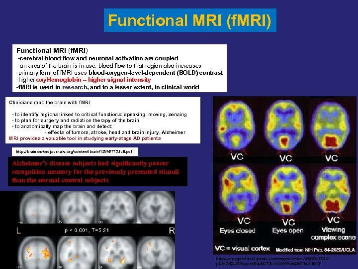 Functional MRI (f. MRI) -cerebral blood flow and neuronal activation are coupled - an