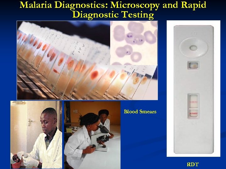 Malaria Diagnostics: Microscopy and Rapid Diagnostic Testing Blood Smears RDT 