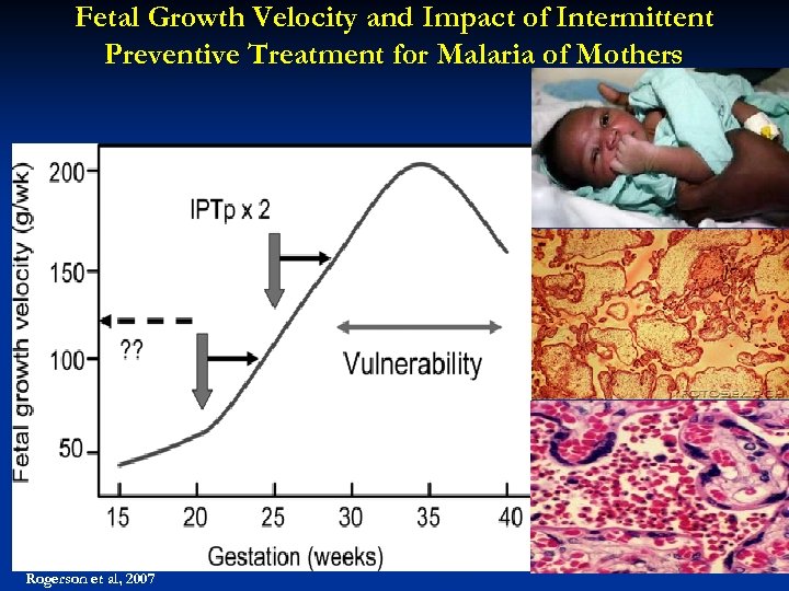 Fetal Growth Velocity and Impact of Intermittent Preventive Treatment for Malaria of Mothers Rogerson