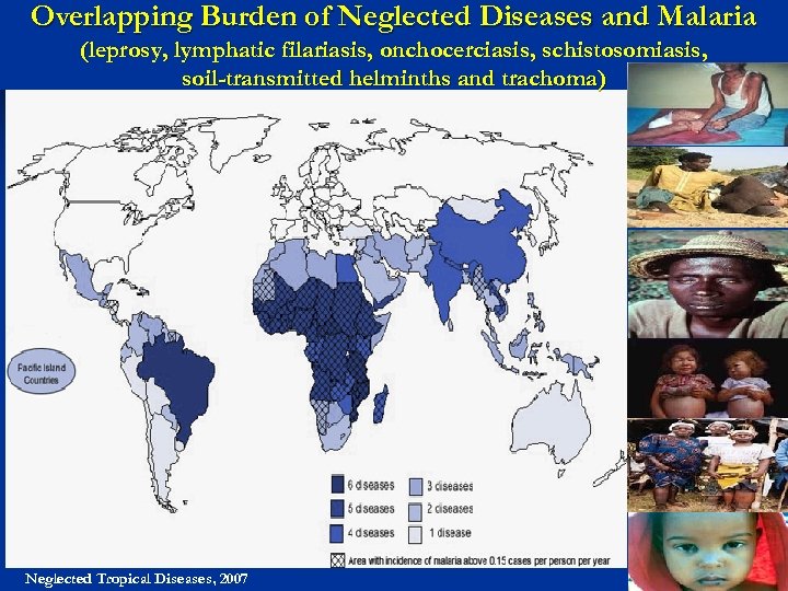 Overlapping Burden of Neglected Diseases and Malaria (leprosy, lymphatic filariasis, onchocerciasis, schistosomiasis, soil-transmitted helminths