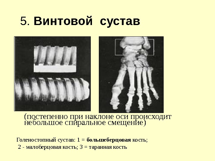 (постепенно при наклоне оси происходит небольшое спиральное смещение) Голеностопный сустав: 1 = большеберцовая кость;