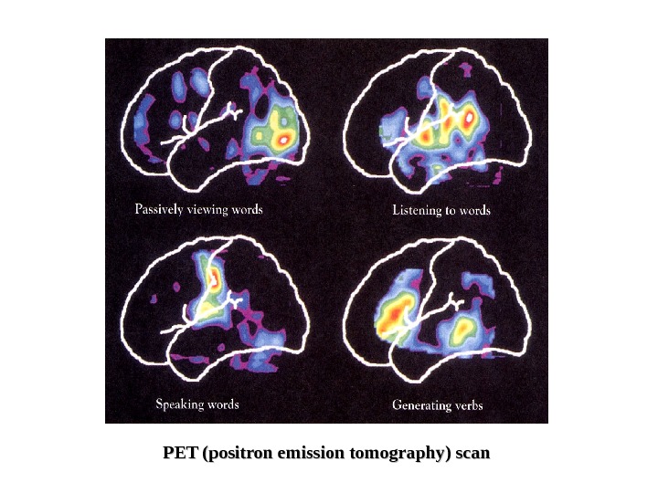  PET (positron emission tomography) scan 