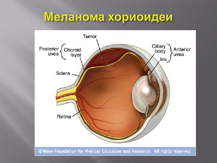 Хориоидея глаза. Ciliary Valleys офтальмология. Uvea склеральные путь. Uvea перевод.