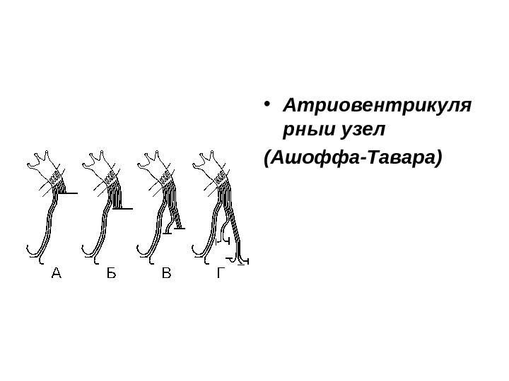  • Атриовентрикуля рныи узел (Ашоффа-Тавара) 