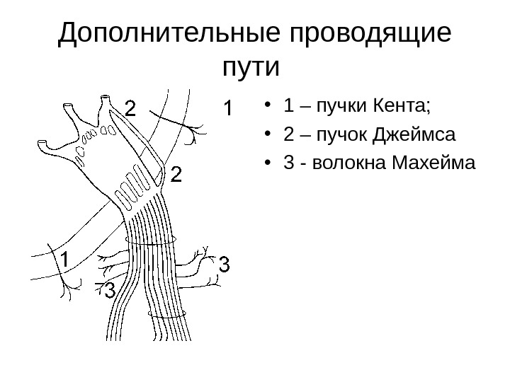 Дополнительные проводящие пути  • 1 – пучки Кента;  • 2 – пучок