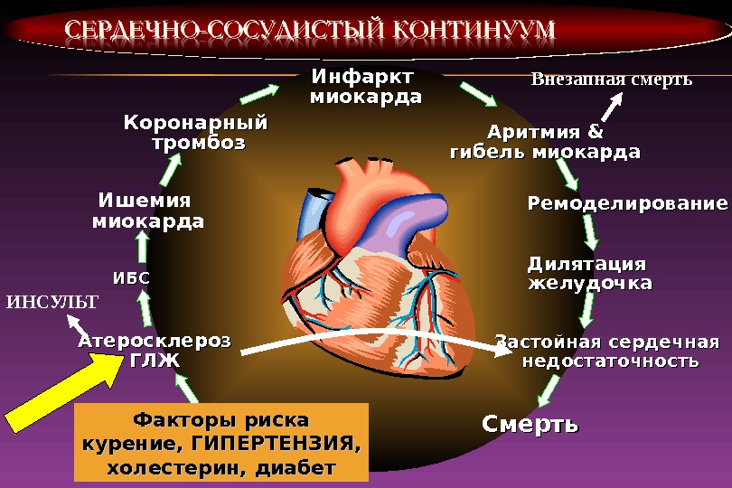 Инфаркт миокарда Аритмия & & гибель миокарда Ремоделирование Дилятация желудочка Застойная сердечная недостаточность Смерть.