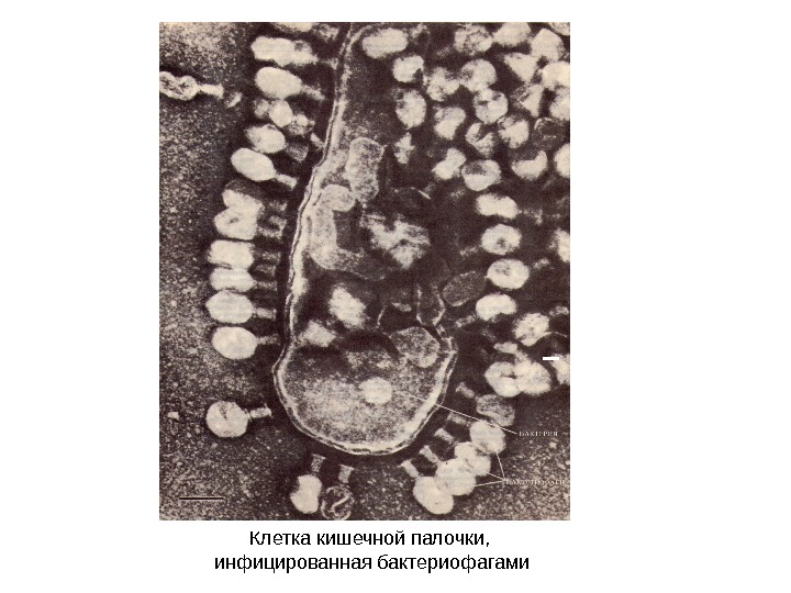 Клетка кишечной палочки,  инфицированная бактериофагами 