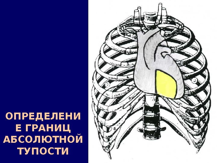 ОПРЕДЕЛЕНИ Е ГРАНИЦ АБСОЛЮТНОЙ ТУПОСТИ 