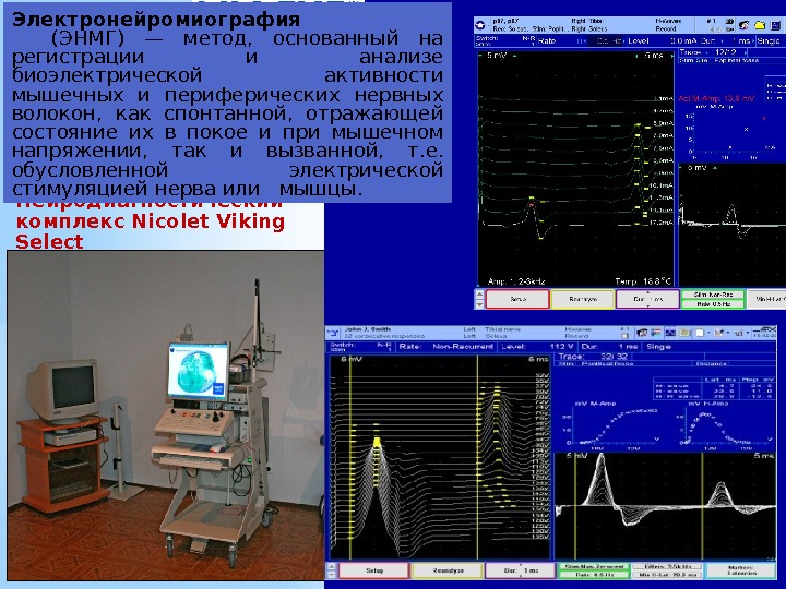 Нейродиагностический комплекс Nicolet Viking Select Электронейромиография  (ЭНМГ) — метод,  основанный на регистрации