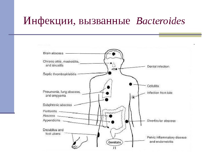 Инфекции, вызванные  Bacteroides 