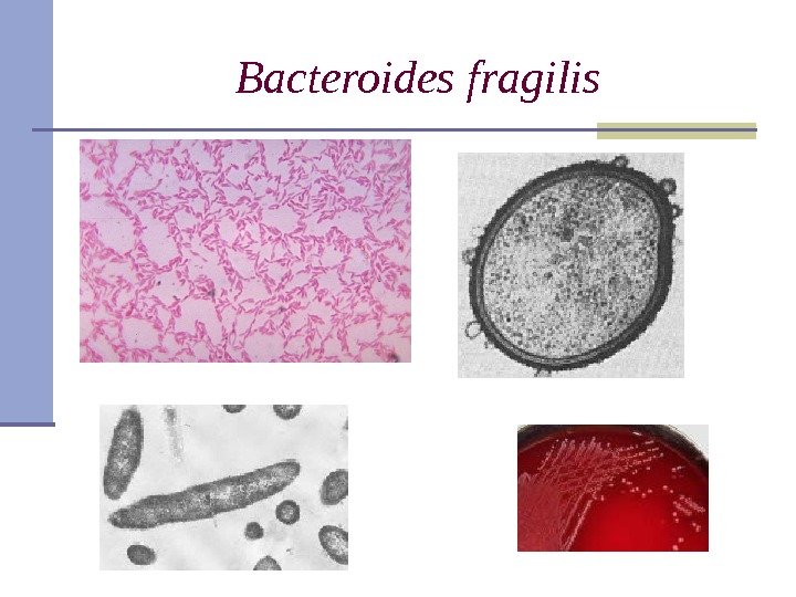 Bacteroides fragilis 