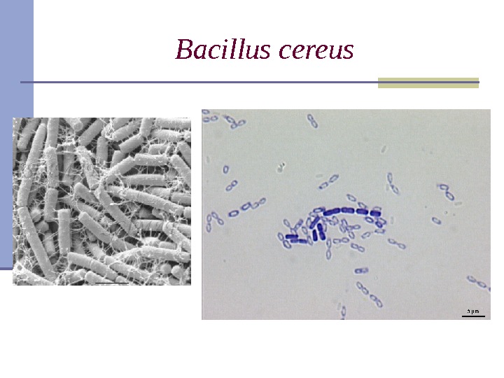 Bacillus с ereus 