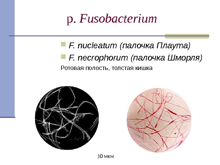 p.  Fusobacterium F. nucleatum (палочка Плаута) F. necrophorum  (палочка Шморля ) Ротовая