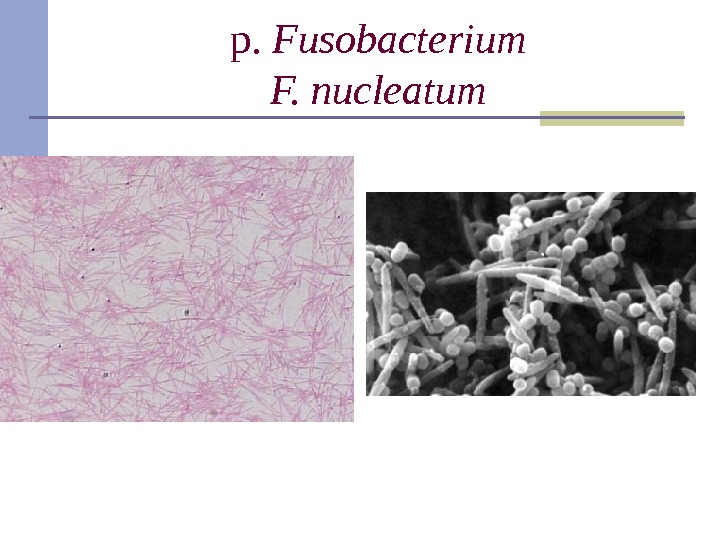 p.  Fusobacterium F. nucleatum 