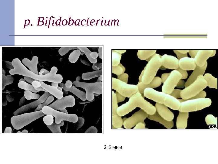 p. Bifidobacterium 2 -5 мкм 
